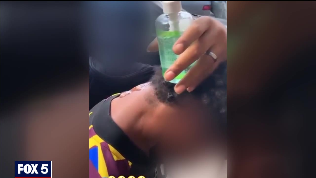 Mother is heartbroken after DC man with mental heath disorders set on fire in viral video